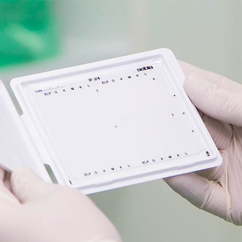 Gel Electrophoresis