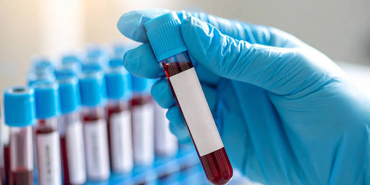 Blood Collection