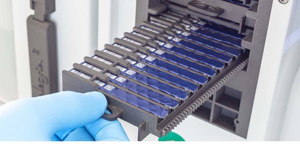 Autoimmune Disease Assays