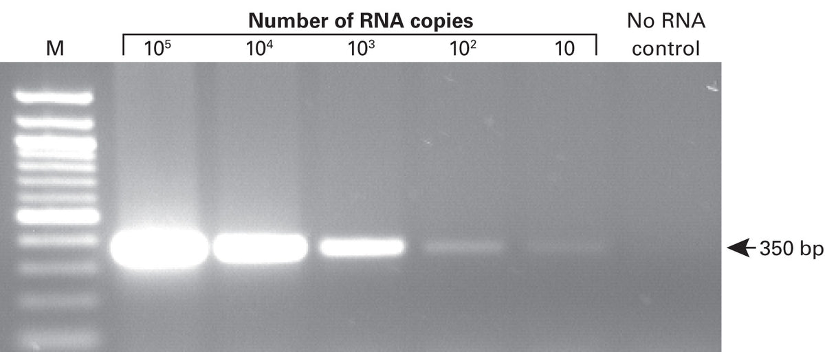 SMARTScribe™ Reverse Transcriptase 639537 - Mrna And Cdna Synthesis - Takara Bio