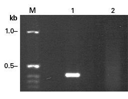 High Fidelity PCR EcoDry™ Premix 639282 - PCR - Takara Bio