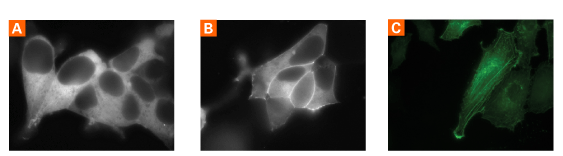 pAutophagSENSE Vector 632583 - Gene function - Takara Bio