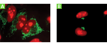 pAutophagSENSE Vector 632583 - Gene function - Takara Bio