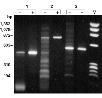 TaqStart® Antibody 639251 - PCR - Takara Bio