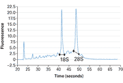 Human Lung Tumor Total RNA 636633 - mRNA and cDNA synthesis - Takara Bio