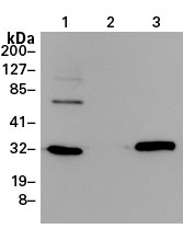 Living Colors® Full-Length GFP Polyclonal Antibody 632592 - Antibodies and ELISA - Takara Bio
