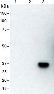 DmrC Polyclonal Antibody 635091 - Gene function - Takara Bio