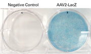 AAVpro® Helper Free System (AAV1-LacZ) 6669 - Gene function - Takara Bio