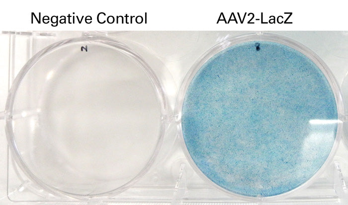 AAVpro® Helper Free System (AAV1-LacZ) 6669 - Gene function - Takara Bio