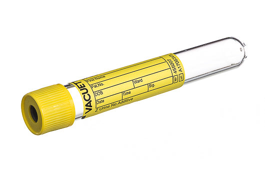 VACUETTE® TUBE, Z URINE NO ADDITIVE - 10 ml / 16x100 Yellow Cap-Yellow Ring, Round Base, Non-Ridged - Greiner Bio-One (455007)
