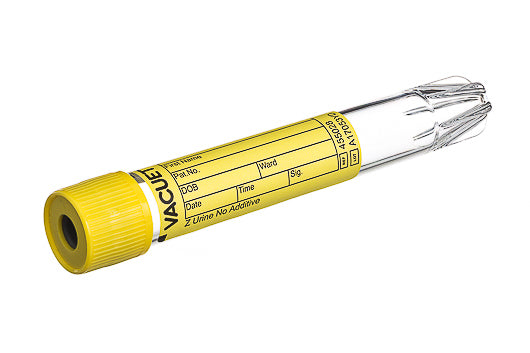 VACUETTE® TUBE, Z URINE NO ADDITIVE - 9 ml / 16x100 Yellow Cap-Yellow Ring, Conical Base, Non-Ridged - Greiner Bio-One (455028)