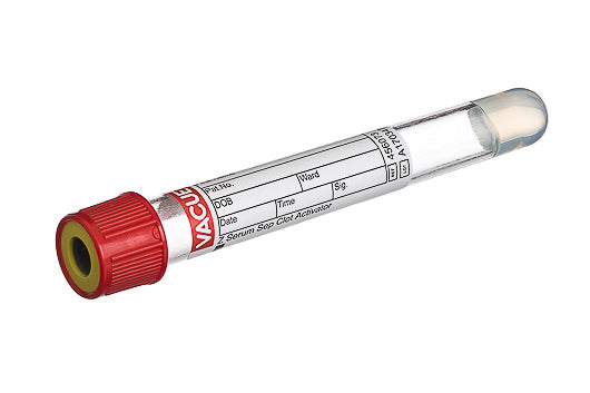 VACUETTE® TUBE 5 ml CAT Serum Separator Clot Activator - Venous Blood Collection - Greiner Bio-One (456073)