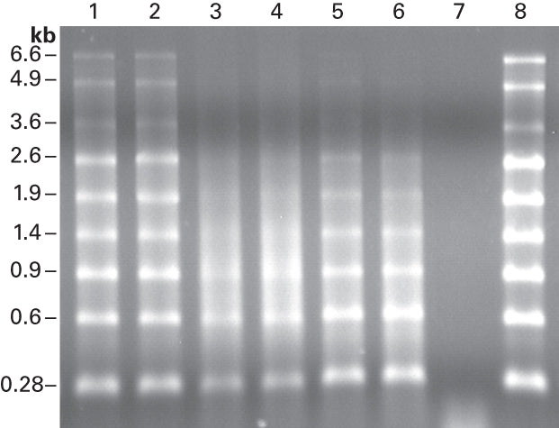 SMART® MMLV Reverse Transcriptase 639524 - Mrna And Cdna Synthesis - Takara Bio
