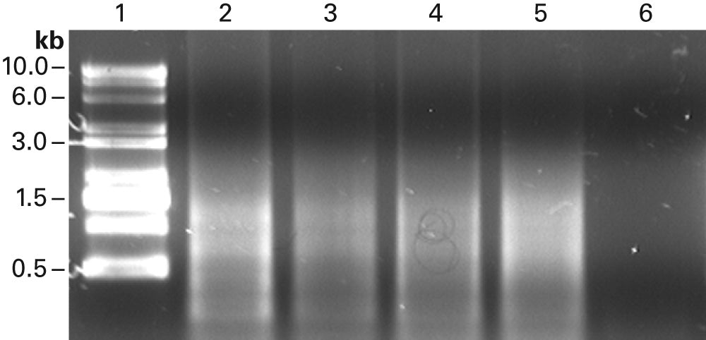 SMART® MMLV Reverse Transcriptase 639524 - mRNA and cDNA synthesis - Takara Bio