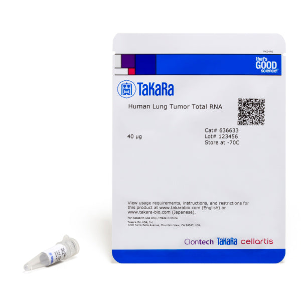 Human Lung Tumor Total RNA 636633 - mRNA and cDNA synthesis - Takara Bio