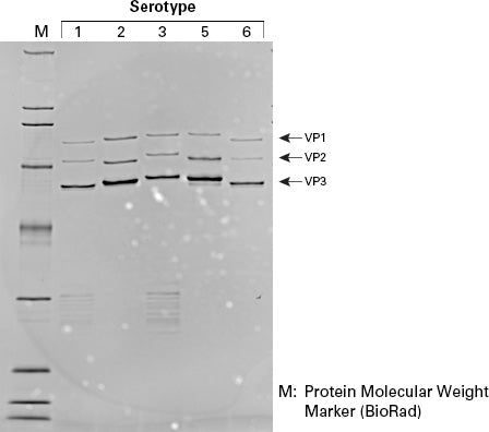 AAVpro® Cell & Sup. Purification Kit Maxi (All Serotypes) 6676 - Gene function - Takara Bio
