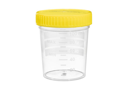 MULTIPURPOSE BEAKER, polypropylene, 120 ml graduated - Yellow Lid / Sterile bulk-packed - Greiner Bio-One (724410)