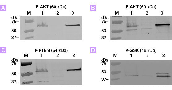 TALON® PMAC Magnetic Phospho Enrichment Kit 635641 - Protein research - Takara Bio