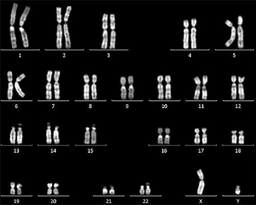 Cellartis® MSC Xeno-Free GMP Grade Culture Medium Y50210 - Stem cell research - Takara Bio