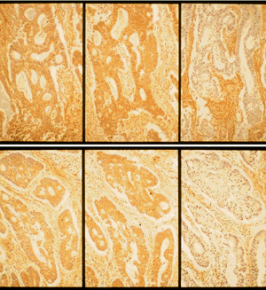 Fibronectin EIA Kit MK115 - Antibodies and ELISA - Takara Bio