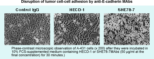 Polyclonal Anti-N-cadherin M142 - Antibodies and ELISA - Takara Bio