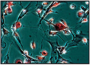 TRACP and ALP Assay Kit MK301 - Antibodies and ELISA - Takara Bio