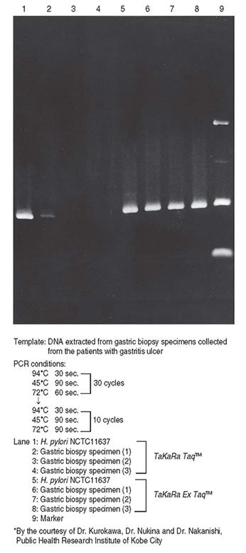 TaKaRa Ex Taq® DNA Polymerase RR001C - PCR - Takara Bio