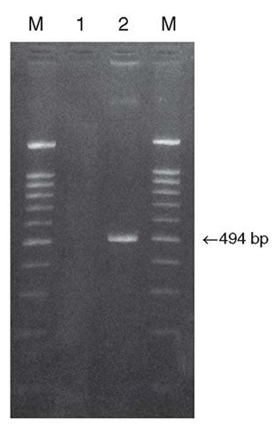 PrimeScript™ One Step RT-PCR Kit, Ver.2 (Dye Plus) RR057B - mRNA and cDNA synthesis - Takara Bio