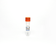 Human Nicotinamide N-Methyltransferase / NNMT Recombinant Protein, Bioactive TBP0002-20UG - Protein & Peptide - TriBioScience