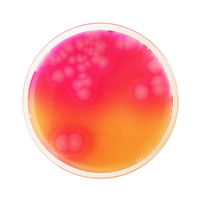 Bacillus Cereus Selective Agar Base (MYP) CO1124 - Microbiology - Condalab