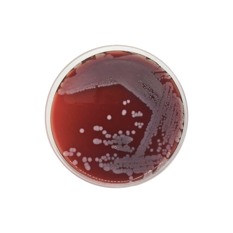 Blood Agar Base CO1108 - Microbiology - Condalab