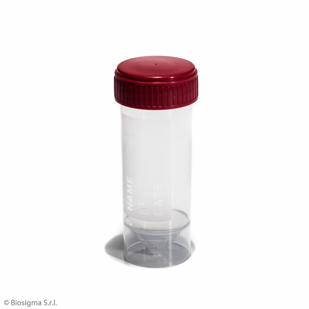 Urine Containers with Screw Cap (BSC123)