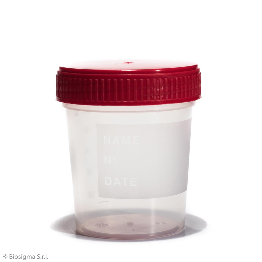 Urine Containers with Screw Cap (BSC123)