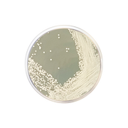 Glucose Chloramphenicol Agar CO1094 - Microbiology - Condalab