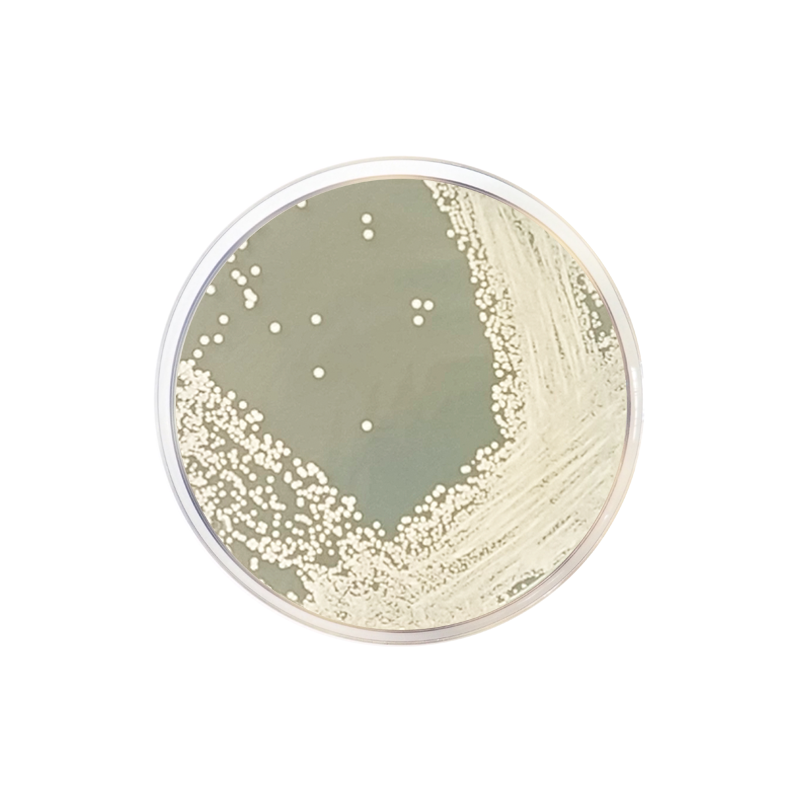 Glucose Chloramphenicol Agar CO1094 - Microbiology - Condalab