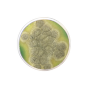 M-Green Yeast and Mold Agar CO2108 - Microbiology - Condalab