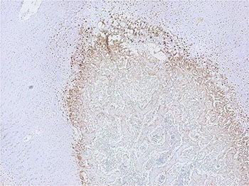 TaKaRa® POD Conjugate Anti Mouse, For Tissue MK204 - Antibodies and ELISA - Takara Bio