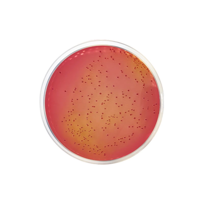 MacConkey Agar with Sorbitol (CT-SMAC) ISO CO1099 - Microbiology - Condalab