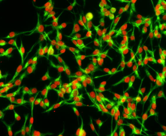 RHB-A® Y40001 - Stem cell research - Takara Bio