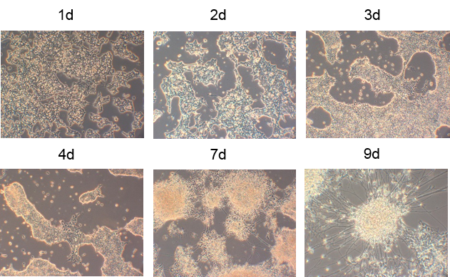 NDiff® 227 Y40002 - Stem Cell Research - Takara Bio
