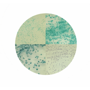 Staphylococcus Chromogenic Agar 2076 - Microbiology - Condalab