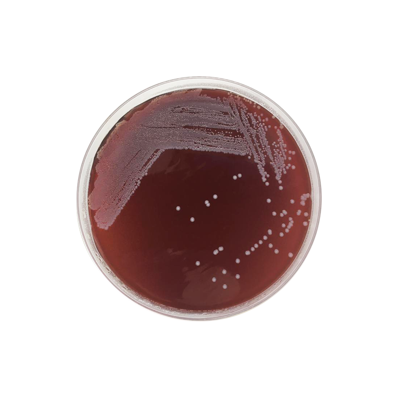 Tryptose Blood Agar Base 1162 - Microbiology - Condalab