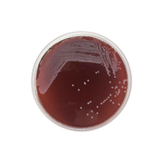 Tryptose Blood Agar Base CO1162 - Microbiology - Condalab